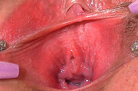 Daily Gape My Pussy Accounts s2
